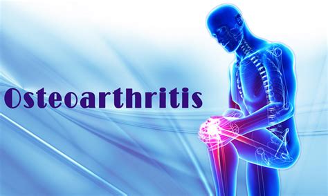 dramacool.com.oa|is osteoarthritis a physical disability.